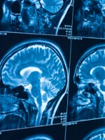 Understanding Neuroscience and Neuropsychology