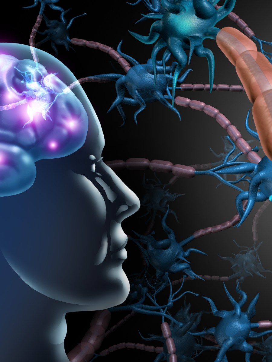 An Imbalance in the Autism Spectrum Disorder Brain?