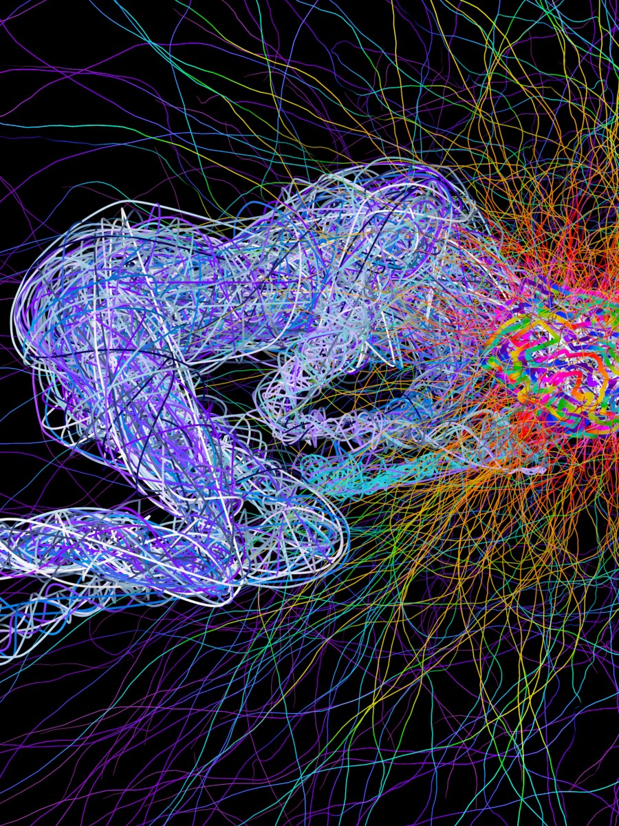 Sleep Hygiene and Brain Health