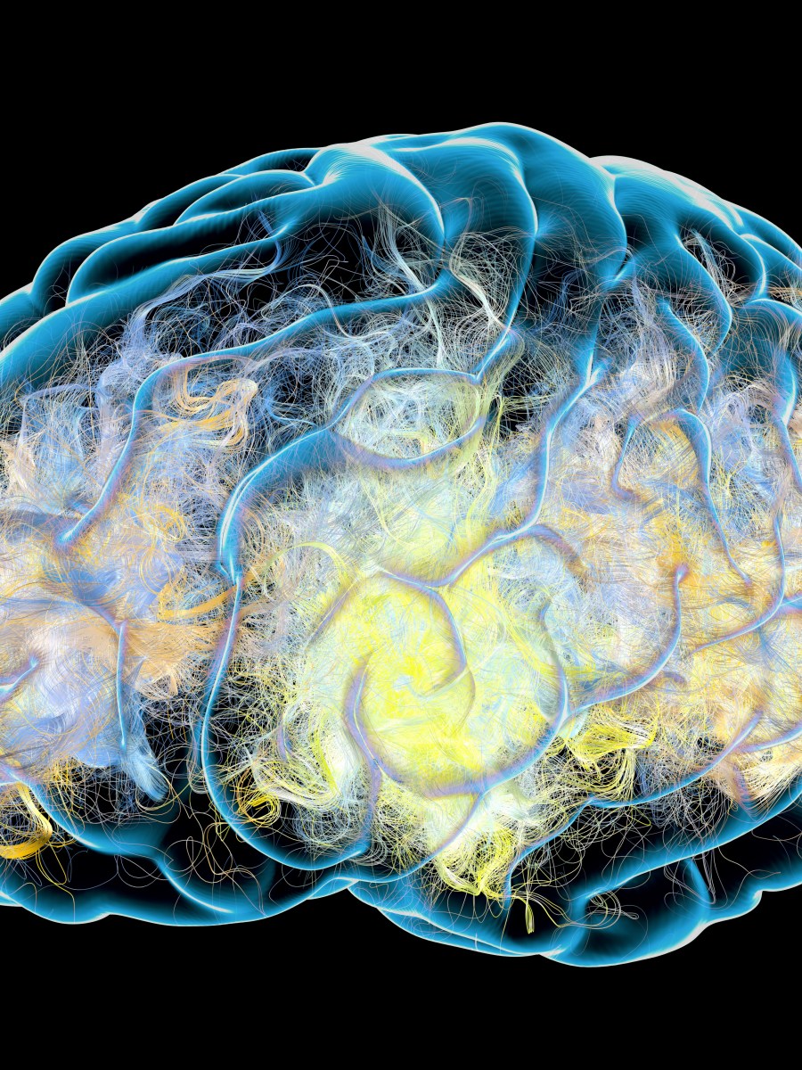 Inattentional Blindness: An Issue That Even Experts Face!