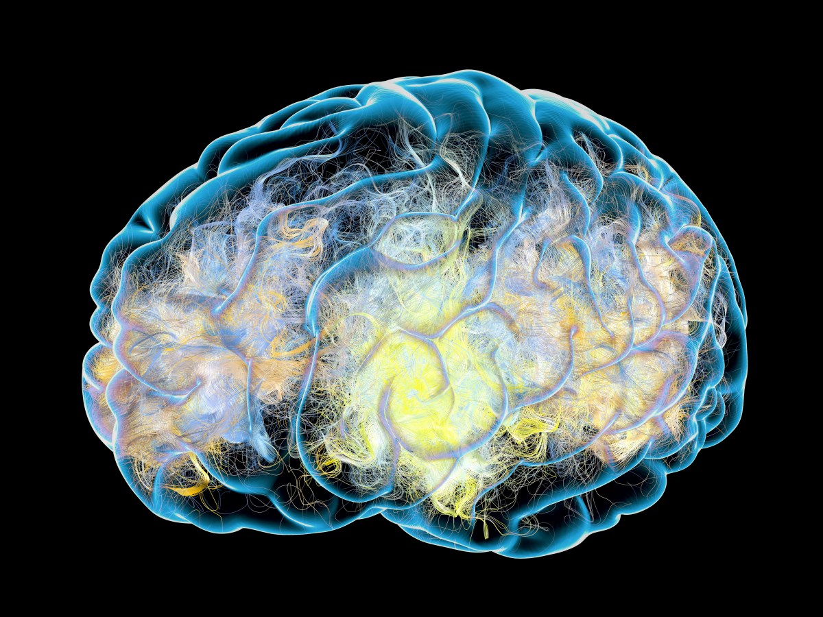 Inattentional Blindness: An Issue That Even Experts Face!