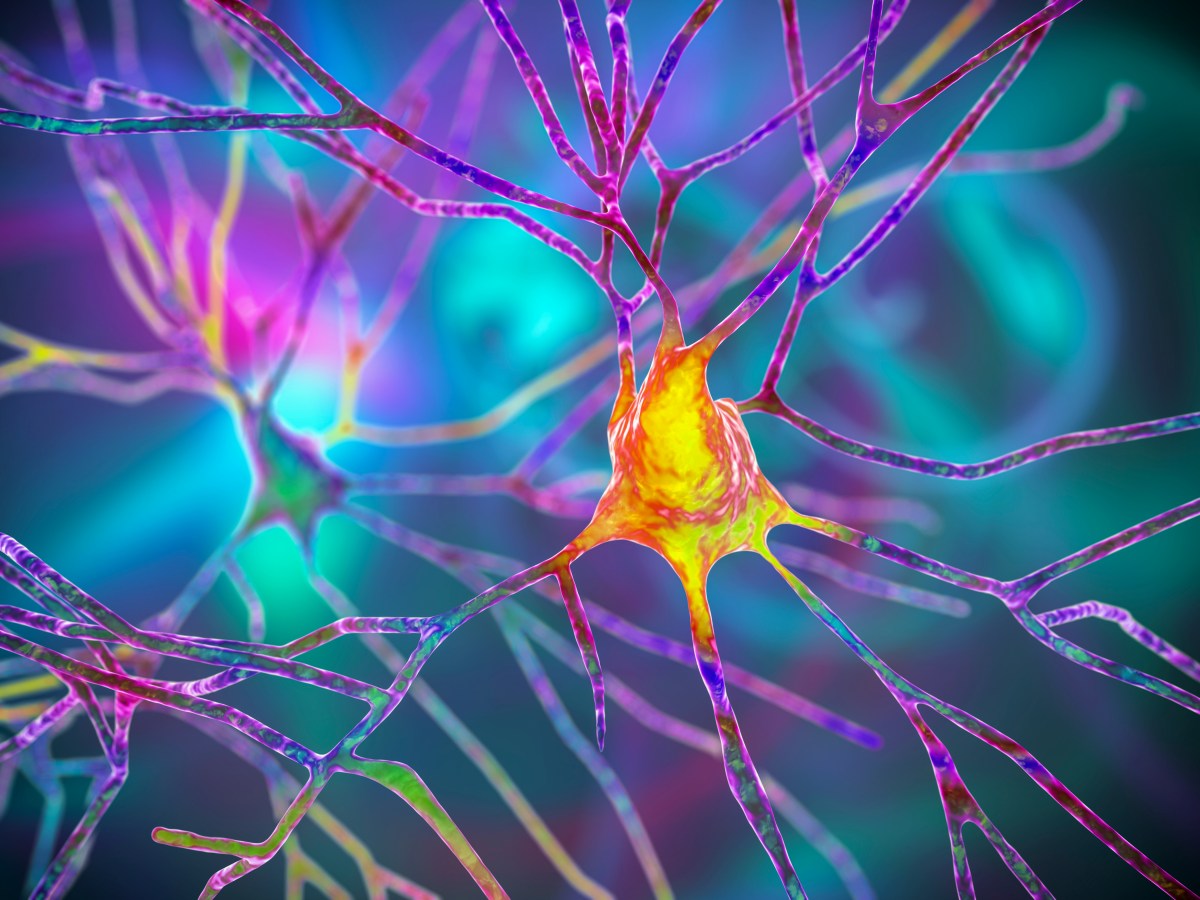 Execessive Neural Noise in Developmental Dyslexia?